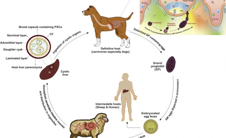 Εχινόκοκκος κύστη. 1 σπάνια εντόπιση εχινοκόκκου κύστης κάτω από το στήθος 11 εχινόκοκκος κύστη
