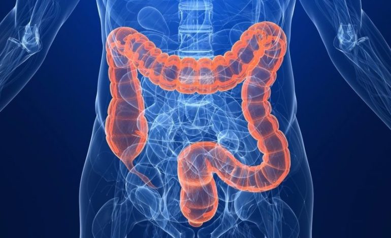 Καρκίνος παχέος εντέρου. Διάγνωση και θεραπεία 19 Καρκίνος παχέος εντέρου