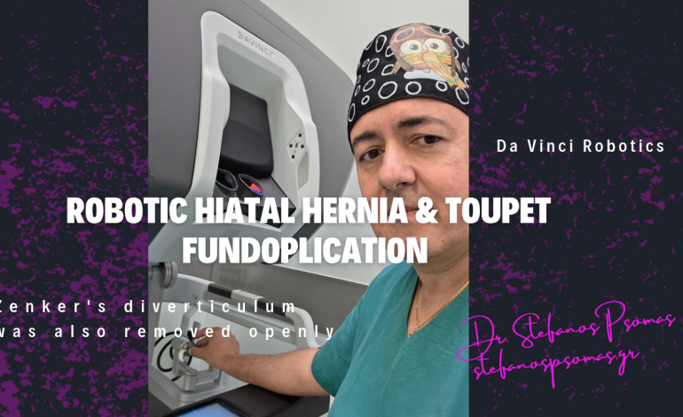 ΡΟΜΠΟΤΙΚΗ ΑΠΟΚΑΤΑΣΤΑΣΗ ΚΑΤΑ TOUPET ΟΛΙΣΘΑΙΝΟΥΣΑΣ ΔΙΑΦΡΑΓΜΑΤΟΚΗΛΗΣ ΚΑΙ ΤΑΥΤΟΓΧΡΟΝΗ ΑΦΑΙΡΕΣΗ ΕΚΚΟΛΠΩΜΑΤΟΣ ZENKER ΟΙΣΟΦΑΓΟΥ ΣΤΗΝ ΙΔΙΑ ΑΣΘΕΝΗ. 14 ROBOTIC 20250606 192509 0000