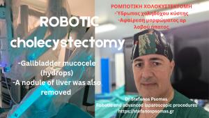 Ρομποτική χολοκυστεκτομή 
