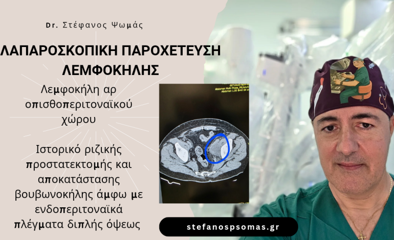 ΛΑΠΑΡΟΣΚΟΠΙΚΗ ΠΑΡΟΧΕΤΕΥΣΗ ΛΕΜΦΟΚΗΛΗΣ ΑΡΙΣΤΕΡΟΥ ΟΠΙΣΘΟΠΕΡΙΤΟΝΑΪΚΟΥ ΧΩΡΟΥ. 9 Laparoscopic drainage of lemphocele 20250806 215215 0000